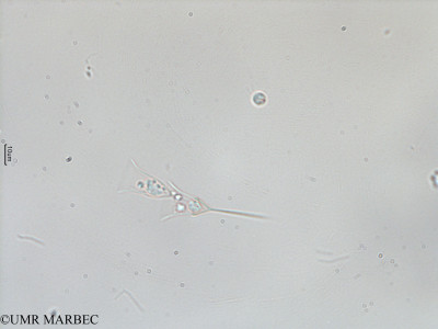 phyto/Mayotte/dziani/DZIANI 2007-2016/Dinobryon sp1 (Effluent2012_Dinobryon -2).tif(copy)_thumb.jpg